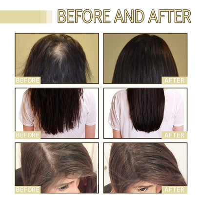 Rosemary Nourishing Hair Growth Serum Oil