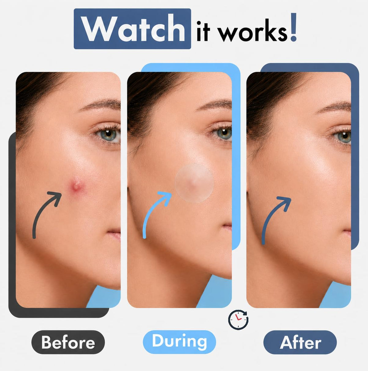 Hydrocolloid Spot Patches (Multi-pack)